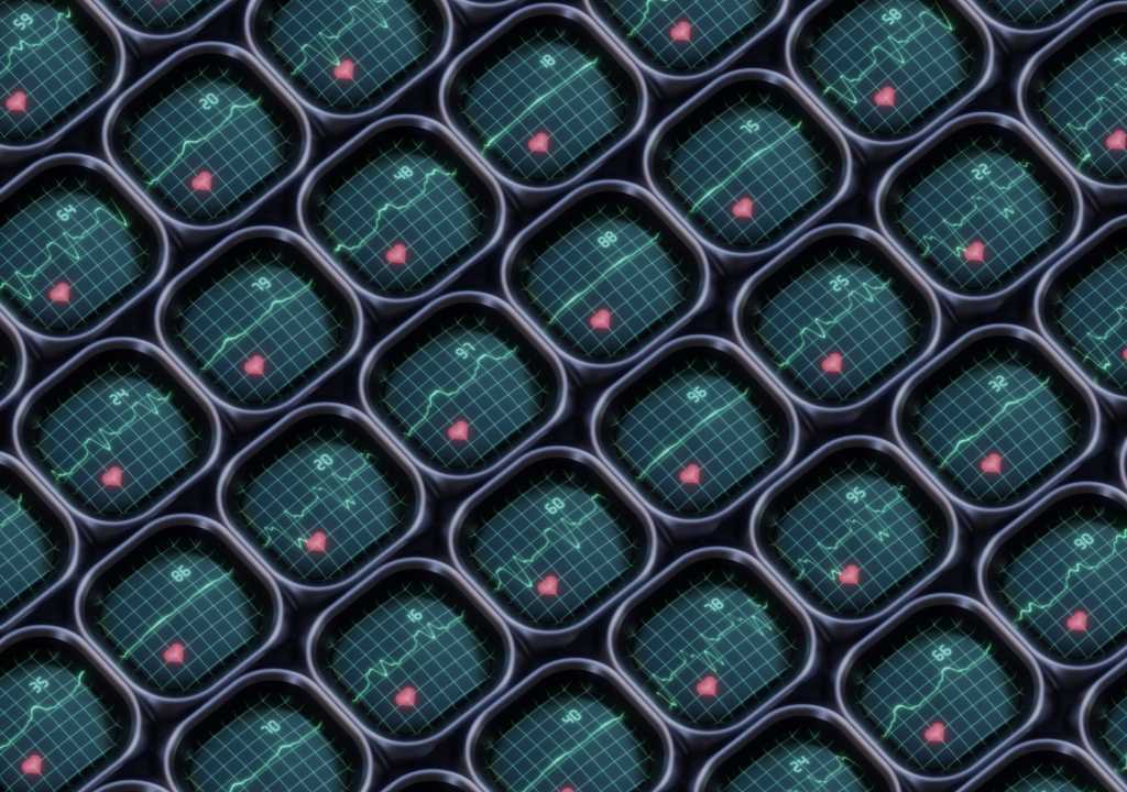 Heart Monitors displaying graphs with different heart rates.